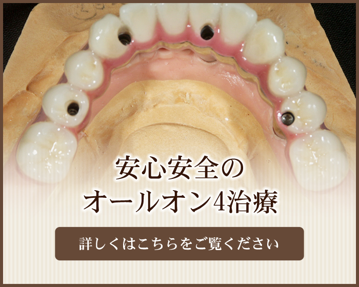 札幌エリア最安値のオールオン4治療
