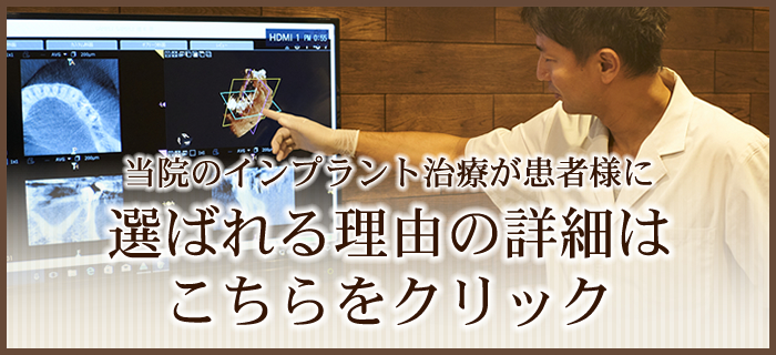 当院のインプラント治療が選ばれる8つの理由はこちら